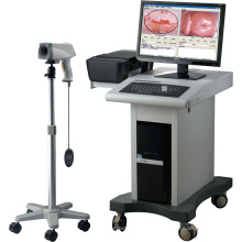 Medizinische Geräte gynäkologische Produkte digitale Kolposkop Imaging-System